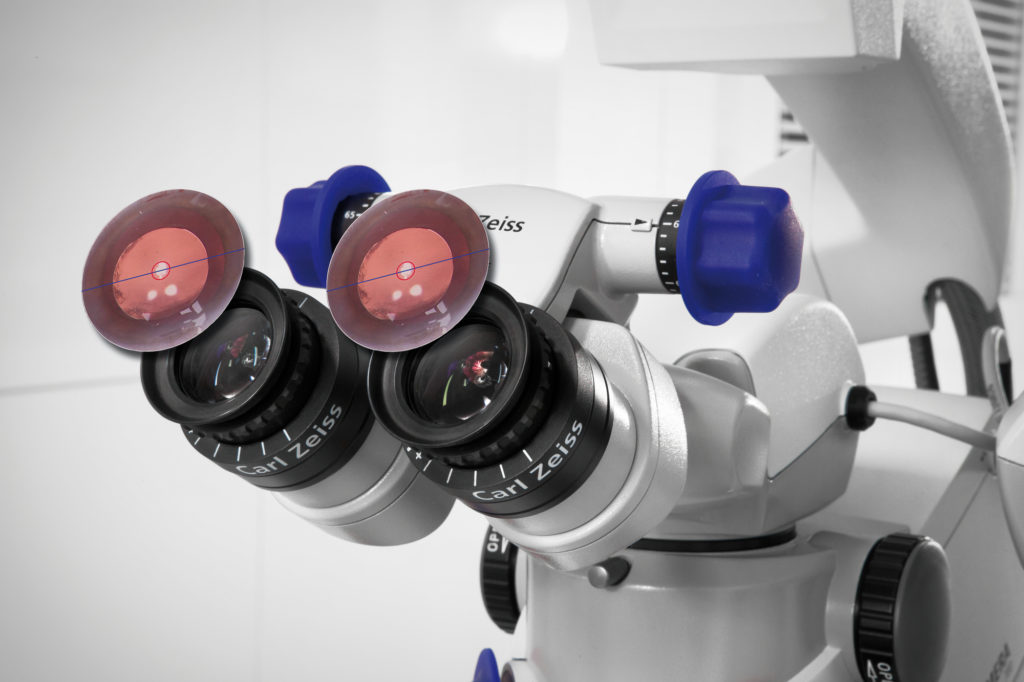 Callisto by Zeiss